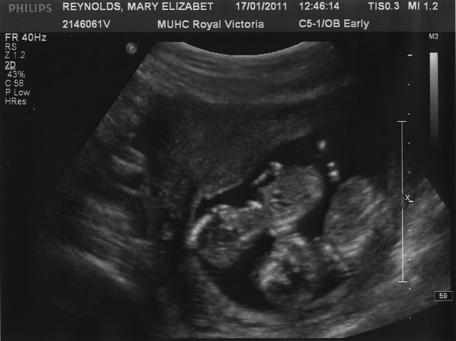 2011-01-17 - Week 13 Scan - 1